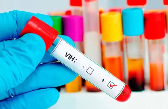 Diagnóstico temprano del VIH: una herramienta clave para reducir muertes en Latinoamérica