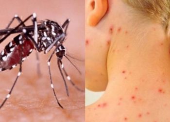 Las otras epidemias en Argentina: hay casi 3 mil casos de dengue y 158 de sarampión De acuerdo al último boletín epidemiológico difundido por el Ministerio de Salud, ya son 2.942 los casos confirmados y probables para dengue en el país, con 6 fallecidos.