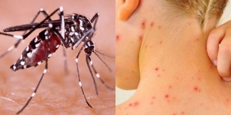 Las otras epidemias en Argentina: hay casi 3 mil casos de dengue y 158 de sarampión De acuerdo al último boletín epidemiológico difundido por el Ministerio de Salud, ya son 2.942 los casos confirmados y probables para dengue en el país, con 6 fallecidos.
