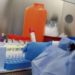Coronavirus: Lanús Registró Un Nuevo Caso Y Ya Son 36 Los Infectados