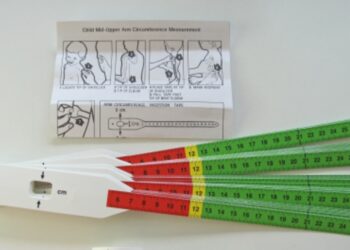 Distribuyen en la Argentina una innovadora cinta que permite medir malnutrición en niños