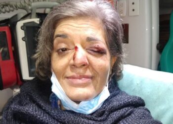 Lanús; Operan a la docente asaltada en Escalada