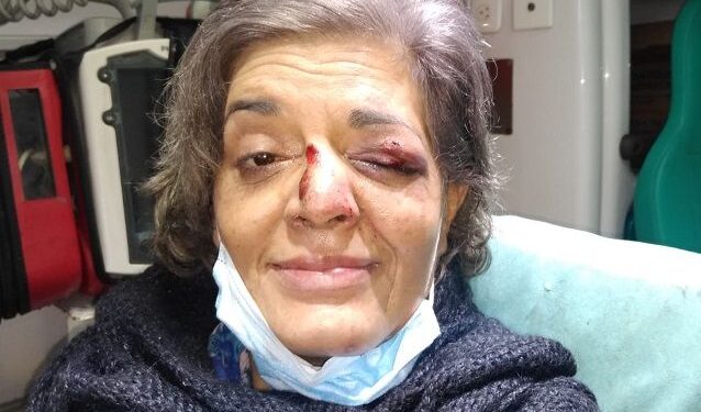 Lanús; Operan a la docente asaltada en Escalada