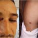 El joven baleado por un subcomisario en Lanús se quiere mudar por miedo