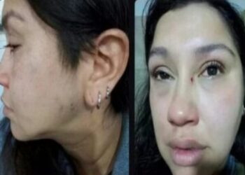 Lanús: Denuncia que su pareja la tuvo encerrada durante más de 6 horas y la golpeó brutalmente