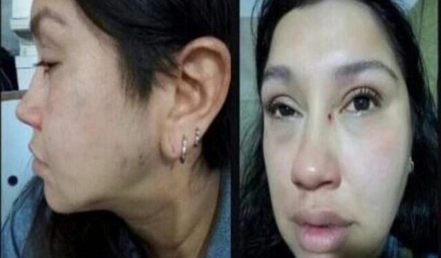 Lanús: Denuncia que su pareja la tuvo encerrada durante más de 6 horas y la golpeó brutalmente