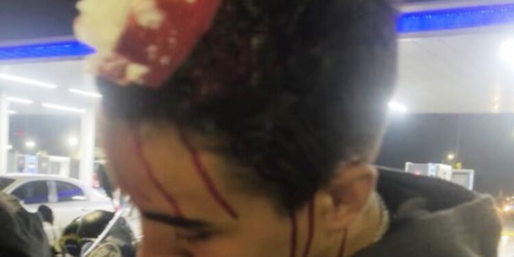 Violencia policial en Wilde: Uno oficial de la Bonaerense agredió a una pareja