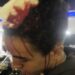 Violencia policial en Wilde: Uno oficial de la Bonaerense agredió a una pareja