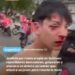 QUILMES: HARTOS DE LOS ROBOS, LOS REPARTIDORES REACCIONARON POR MANO PROPIA